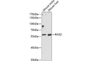 Western blot analysis of extracts of various cell lines using RAG2 Polyclonal Antibody at dilution of 1:1000. (RAG2 Antikörper)