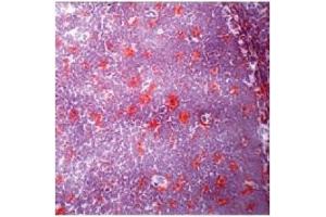 Immunohistochemistry (IHC) image for anti-CD84 (CD84) antibody (ABIN1106590) (CD84 Antikörper)