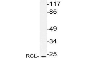 Western blot (WB) analysis of RCL antibody in extracts from Jurkat cells.