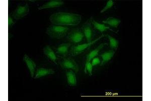 Image no. 4 for anti-PDZ Binding Kinase (PBK) (AA 1-110) antibody (ABIN599274) (PBK Antikörper  (AA 1-110))