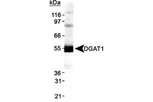 Western blot analysis of DGAT1 in HepG2 lysate using DGAT1 polyclonal antibody . (DGAT1 Antikörper  (AA 200-300))
