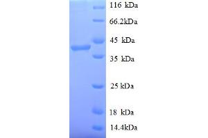 Poly (ADP-Ribose) Polymerase 1 (PARP1) (AA 2-331), (partial) protein (His tag)