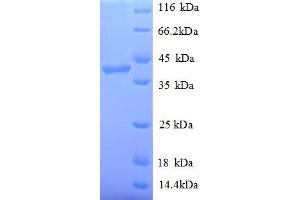 SDS-PAGE (SDS) image for Poly (ADP-Ribose) Polymerase 1 (PARP1) (AA 2-331), (partial) protein (His tag) (ABIN5710069)