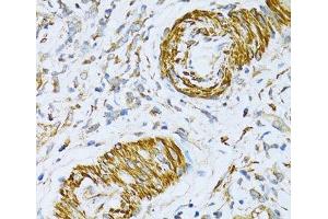 Immunohistochemistry (Paraffin-embedded Sections) (IHC (p)) image for anti-Vesicle-Associated Membrane Protein 1 (Synaptobrevin 1) (VAMP1) antibody (ABIN7264714)