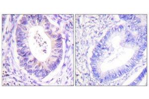 Immunohistochemistry (IHC) image for anti-Ribosomal Protein S6 Kinase, 90kDa, Polypeptide 3 (RPS6KA3) (Thr573) antibody (ABIN1847962) (RPS6KA3 Antikörper  (Thr573))