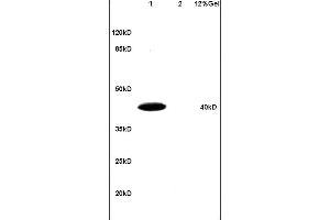 Lane 1: mouse brain lysates Lane 2: human colon carcinoma lysates probed with Anti BNIP3L Polyclonal Antibody, Unconjugated (ABIN714911) at 1:200 in 4 °C.