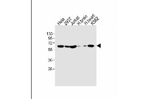 All lanes : Anti-IFNAR1 Antibody (Center) at 1:1000 dilution Lane 1: Hela whole cell lysate Lane 2: 293T whole cell lysate Lane 3: Jurkat whole cell lysate Lane 4: human brain lysate Lane 5: human heart lysate Lane 6: K562 whole cell lysate Lysates/proteins at 20 μg per lane. (IFNAR1 Antikörper  (AA 162-188))
