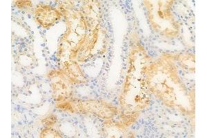 ABIN7097106 and ABIN7101173 at 1/100 staining human normal kidney tissue by IHC-P.