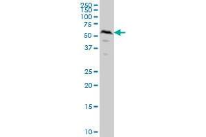 SMAD1 monoclonal antibody (M04), clone 2A1 Western Blot analysis of SMAD1 expression in HeLa .