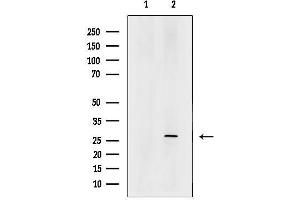 Western blot analysis of lysates from mouse pancreas tissue, using C14orf166 Antibody.