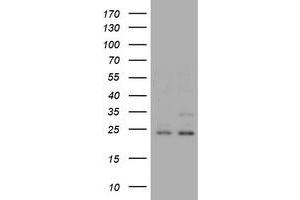 Image no. 2 for anti-RAB21, Member RAS Oncogene Family (RAB21) antibody (ABIN1500546) (RAB21 Antikörper)