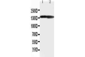 Anti-Collagen II antibody,  Western blotting Lane 1: Rat Heart Tissue Lysate Lane 1: Rat Brain Tissue Lysate (COL2A1 Antikörper  (C-Term))