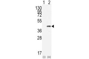 Western blot analysis of CDX2 antibody and 293 cell lysate (2 ug/lane) either nontransfected (Lane 1) or transiently transfected with the human gene (2). (CDX2 Antikörper  (AA 1-30))