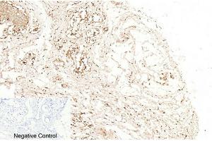 Immunohistochemical analysis of paraffin-embedded human breast tissue. (Caspase 1 Antikörper  (Cleaved-Asp210))
