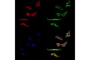 ABIN6262736 and ABIN6277134 staining Hela cells by IF/ICC. (KBTBD3 Antikörper  (C-Term))