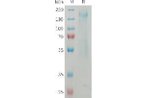 SDS-PAGE (SDS) image for Protein tyrosine Phosphatase, Receptor Type, C (PTPRC) (AA 26-566) protein (His tag) (ABIN7538492)