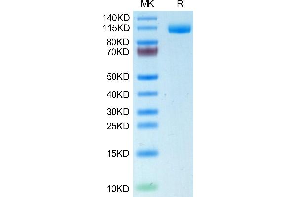 CD22 Protein (AA 20-687) (His tag)