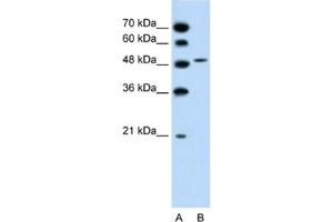 Western Blotting (WB) image for anti-Solute Carrier Family 10 (Sodium/bile Acid Cotransporter Family), Member 5 (SLC10A5) antibody (ABIN2462731) (SLC10A5 Antikörper)
