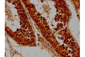 IHC image of ABIN7171134 diluted at 1:300 and staining in paraffin-embedded human testis tissue performed on a Leica BondTM system. (SYCE3 Antikörper  (AA 1-88))