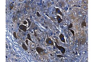 ABIN6259940 and ABIN6268705 at 1/100 staining Rat brain tissue by IHC-P. (Annexin A3 Antikörper  (N-Term))