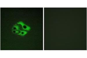 Immunofluorescence analysis of HeLa cells, using BAD (Phospho-Ser134) Antibody. (BAD Antikörper  (pSer134))
