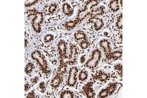 Immunohistochemical staining of human breast with ZNF146 polyclonal antibody  shows strong nuclear positivity in glandular cells at 1:50-1:200 dilution. (ZNF146 Antikörper)