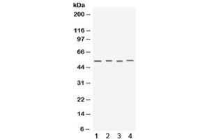 Western blot testing of 1) mouse testis, 2) mouse skeletal muscle, 3) human MCF7 and 4) human A549 lysate with Keratocan antibody. (KERA Antikörper)