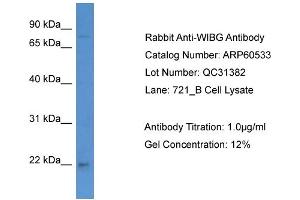WB Suggested Anti-WIBG  Antibody Titration: 0. (PYM Antikörper  (C-Term))