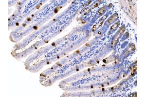 IHC analysis of MUC2 using anti-MUC2 antibody (ABIN7600606).