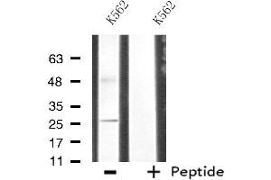 Western blot analysis of extracts from K562 cells, using CDC42EP3 antibody. (CDC42EP3 Antikörper  (Internal Region))