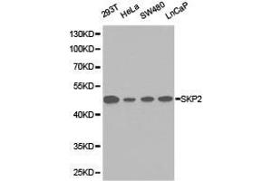 Western Blotting (WB) image for anti-S-Phase Kinase-Associated Protein 2 (SKP2) antibody (ABIN1874793) (SKP2 Antikörper)