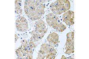 Immunohistochemistry of paraffin-embedded human stomach using RAPSN antibody (ABIN6132583, ABIN6146690, ABIN6146691 and ABIN6222434) at dilution of 1:100 (40x lens). (RAPSN Antikörper  (AA 1-353))