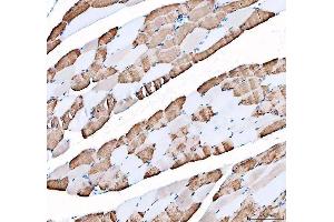 IHC analysis of ATP2A1 using anti-ATP2A1 antibody (ABIN3043792).
