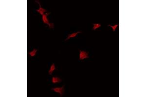 ABIN6275059 staining Hela by IF/ICC. (DKK3 Antikörper  (C-Term))