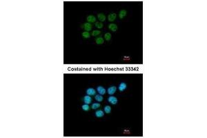ICC/IF Image Immunofluorescence analysis of paraformaldehyde-fixed A431, using ARIH2, antibody at 1:200 dilution. (ARIH2 Antikörper  (C-Term))