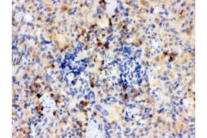 Immunohistochemistry (IHC) image for anti-Toll-Like Receptor 7 (TLR7) antibody (ABIN4952861)