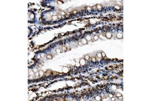 IHC analysis of USP16 using anti-USP16 antibody (ABIN7602640). (USP16 Antikörper  (AA 9-823))