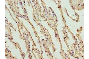 Immunohistochemistry of paraffin-embedded human lung tissue using ABIN7151751 at dilution of 1:100 (PROCR Antikörper  (AA 18-210))