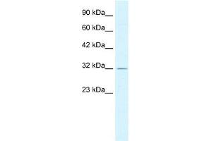 Human HepG2; WB Suggested Anti-PSMD14 Antibody Titration: 0. (PSMD14 Antikörper  (C-Term))