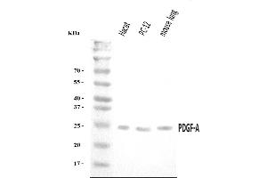 Western blot analysis of PDGF AA/PDGFA using anti-PDGF AA/PDGFA antibody (ABIN7602580). (PDGFA Antikörper  (AA 87-211))