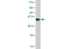 Western Blot detection against Immunogen (36. (ERN1 Antikörper  (AA 401-500))