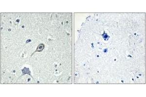 Immunohistochemistry analysis of paraffin-embedded human brain tissue, using CNR1 Antibody. (CNR1 Antikörper  (AA 151-200))
