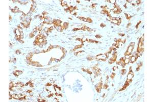 Formalin-fixed, paraffin-embedded human Prostate stained with Aurora B Mouse Monoclonal Antibody (AURKB/1593). (Aurora Kinase B Antikörper  (AA 89-251))