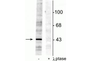 Western blot of rat testes lysate showing specific immunolabeling of the ~46 kDa EphrinB phosphorylated at Tyr298 in the first lane (-). (EPH Receptor B2 Antikörper  (pTyr298))