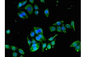Immunofluorescence (IF) image for anti-Endothelin Receptor Type B (EDNRB) (AA 27-101) antibody (ABIN7151760)