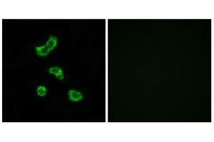 Immunofluorescence analysis of MCF-7 cells, using CA5B antibody. (CA5B Antikörper  (C-Term))