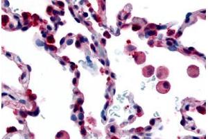 Human Lung, Alveolar Macrophages (formalin-fixed, paraffin-embedded) stained with FFAR2 antibody ABIN213512 at 35 ug/ml followed by biotinylated goat anti-rabbit IgG secondary antibody ABIN481713, alkaline phosphatase-streptavidin and chromogen. (FFAR2 Antikörper  (Extracellular Domain))