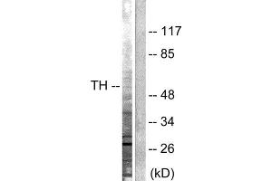 Western Blotting (WB) image for anti-Tyrosine Hydroxylase (TH) (Ser19) antibody (ABIN1847900) (Tyrosine Hydroxylase Antikörper  (Ser19))