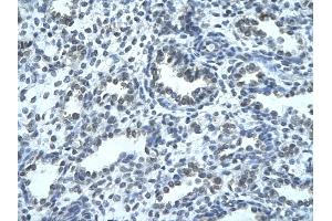 Human Lung; . (IKZF4 Antikörper  (N-Term))
