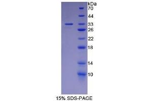 SDS-PAGE (SDS) image for Carbonic Anhydrase 12 (CA12) (AA 25-302) protein (His tag) (ABIN1079050) (CA12 Protein (AA 25-302) (His tag))